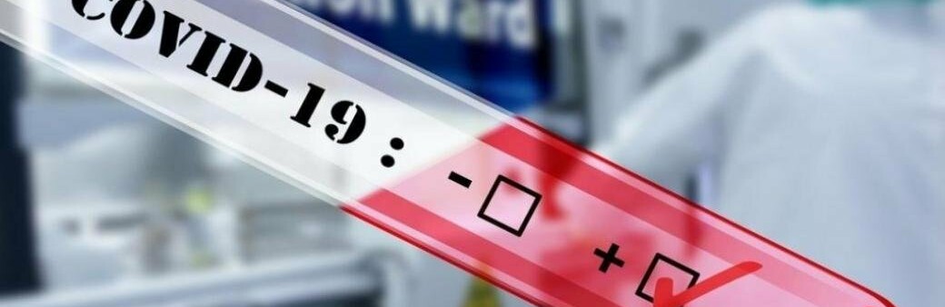  ������� ���� covid-19 ���������� ���������� ����������� �������� 